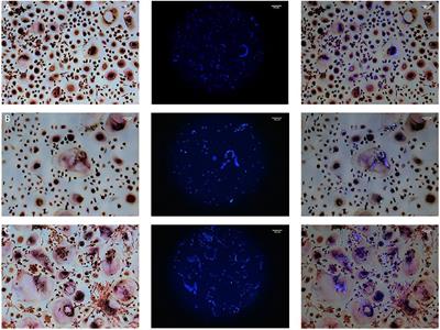 Dental and Orthopaedic Implant Loosening: Overlap in Gene Expression Regulation